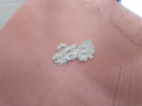 Is this artex?