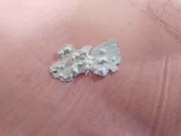 Is this artex?